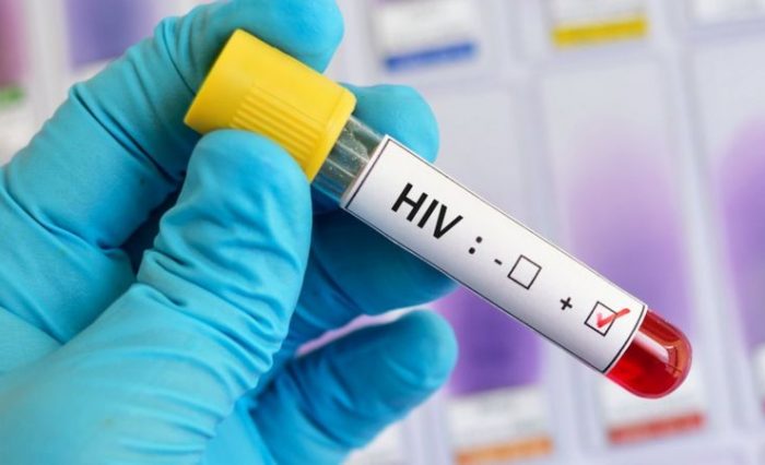 échantillon VIH